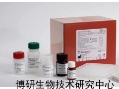 人白細胞共同抗原ELISA試劑盒_供應(yīng)產(chǎn)品_博研生物技術(shù)研究中心
